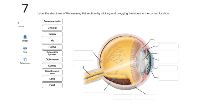 Label the structures in the sagittal section of the eye