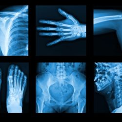 Ray imaging digital radiography xray than diagnostic radiology better film amila ordinacija medical prim med dr upgrading really soft results